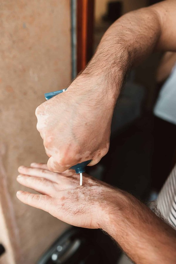 Comment prévenir et traiter les problèmes de peau chez les chinchillas ?